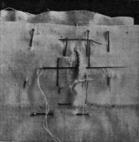 Fig. 3. Tack a small piece of material under the broken buttonhole, to which its edges can be sewn