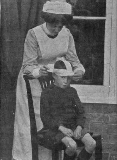 Bandaging the head. 2nd position. The vertical bandage is brought across the top of the head to the root of the nose, the nurse bringing the horizontal bandage round the forehead in her right hand to fix it