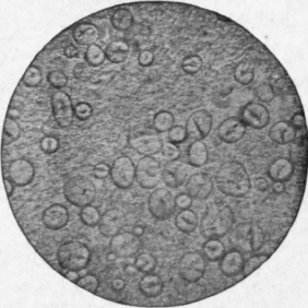 Bean Starch