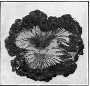 Fig. 104.   Black Knot; cross   section of a diseased twig. The knot has completely encircled the twig.