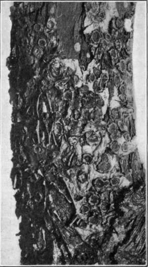 Fig. 22.   Blister Canker of apple. Old canker, showing 