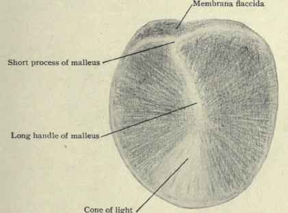Fig. 102.   Outer surface of the tympanic membrane of the left ear, is called Shrapnell' s membrane or membrana flaccida. As it possesses no fibrous â€¢ layer it is weaker than the membrane elsewhere and consequently is a favorite spot for pus to perforate in order to find exit from the middle ear.
