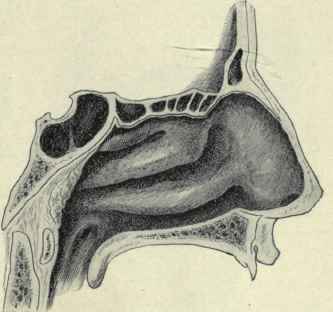 Fig. 121.   Outer wall of nose, showing the superior, middle, and inferior turbinate bones.
