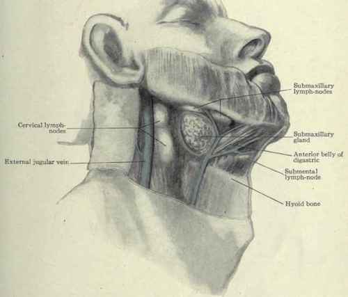 Fig. 163.   Submaxillary region, superficial structures. (From a dissection, lymph nodes enlarged by disease).