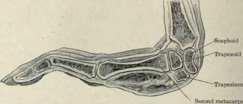 Fig. 344.   Position assumed by the carpal bones in extension of the wrist.