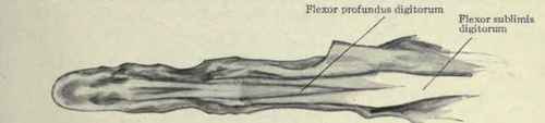 Fig. 362.   Palmar view of the flexor tendons of the finger, showing the insertion of the flexor sublimis into the middle phalanx and the flexor profundus into the distal phalanx.
