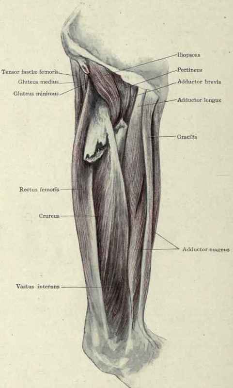 Fig. 540.   Fracture of the femur at the juncture of the upper and middle thirds. Upper fragment drawn forward and outward.