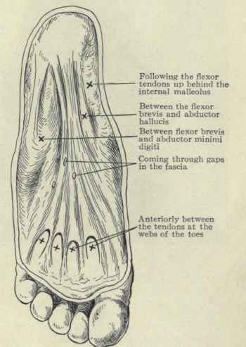 Fig. 594.   Diagram showing the points of exit of suppuration beneath the plantar fascia.