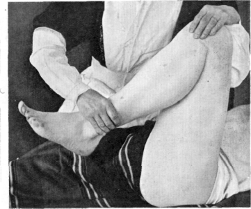 Fig. 107. Flexing the Thigh.