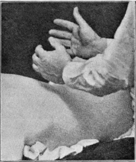 Fig. 20