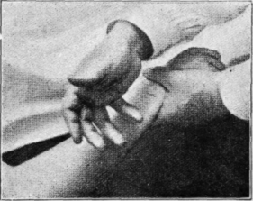 Fig. 21