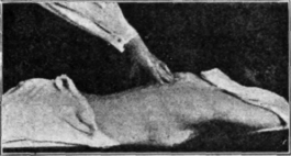 Fig. 22