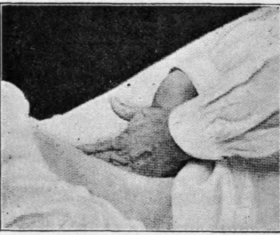 Fig. 27