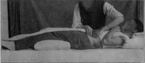Fig. 11.   Friction of the iliac colon. Note that every care is taken to ensure that the abdominal muscles are relaxed; and, a point of distinction between this and other movements, that the inter phalangeal joints are kept fully extended. It is preferable that the masseur should stand on the left side of his patient. He is shown here on the right side owing to the difficulty of reproduction