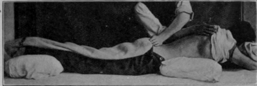 Fig. 126.   Stroking the back. The left hand is finishing one stroke while the right is preparing to begin. This is a very difficult movement, and requires great skill to attain perfection of rhythm