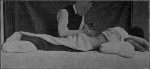 Fig. 13.   Hacking. Mildest form. Note wrist action and position of the fingers