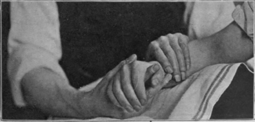 Fig. 21.   To show radial deviation of wrist. Note slight relative pronation