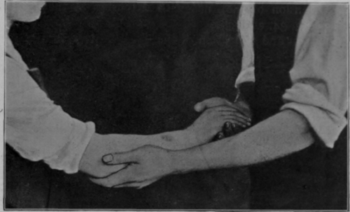 Fig. 27.   To show another position that may be used during later stages of treatment for mobilisation of shoulder and elbow, the latter being extended