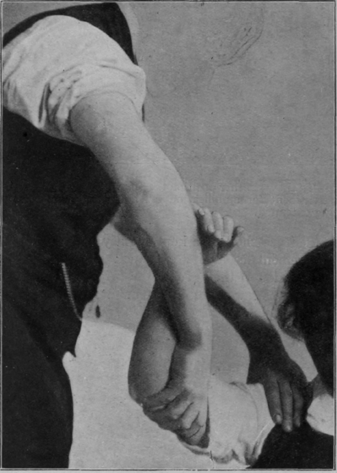 Fig. 29.   To show one position in administering circumduction of shoulder. The support given by the masseur's right hand and arm is identical with that shown in Figs. 25 and 26