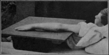 Fig. 43.   To show the starting position for free flexion of the elbow. This is also the end position of free extension