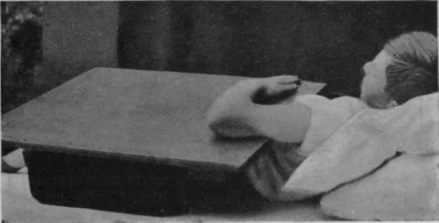 Fig. 44.   To show the starting position for free extension of the elbow. This is also the end position of free flexion