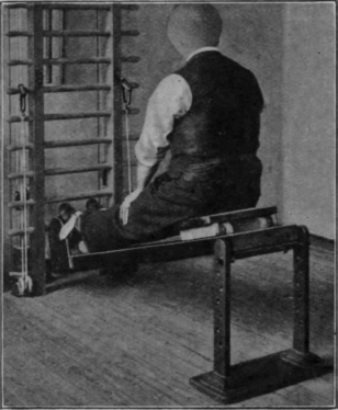 Fig. 51.   The same as Fig. 50, only showing assistance given by the patient to secure full extension