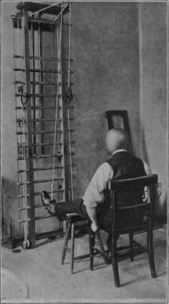 Fig. 52.   To show the first exercise with the weight and pulley for re educating the quadriceps. Note that this muscle is doing no active work at all, provided the weight is adequate to counteract completely that of the limb below the knee