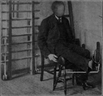 Fig. 53.   Exercising the quadriceps with weight and pulley while sitting. Note that the muscle is now called upon to contract strongly