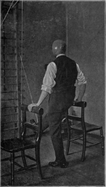 Fig. 54.   To show assistive exercise for the flexors of the hip. Increase of weight gives resistive exercise for the extensors. Note that not only are certain muscles in the limb attached to the apparatus being exercised. The patient is called upon to do valuable balance work on the other limb. Hence it may well be wise to attach the sound limb to the apparatus in order to train, re educate and exercise the injured limb