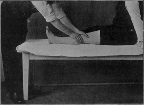 Fig. 8.   Upward stroking of the lower extremity to illustrate some common faults in position