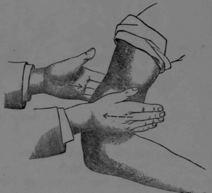 Fig. 10.   Kneading with Both Hands, Called Squeezing.