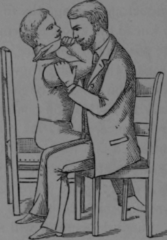 Fig. 114.   Forcing a Stiff Elbow joint.