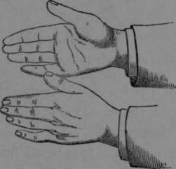 Fig. 12.   Position of Hands in Hacking. 3