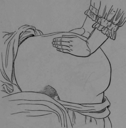 Fig. 16.   Stroking of the Glutei.