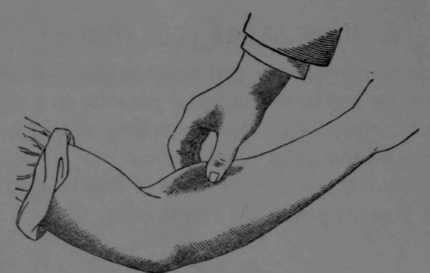 Fig. 9.   Kneading with the Thumb and Fingers, Called Pinching.