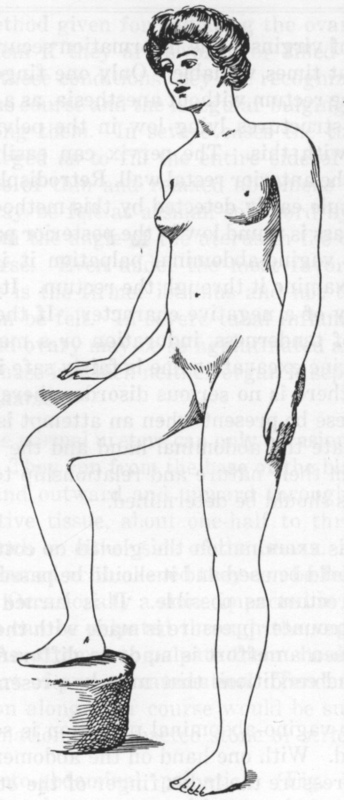 Fig. 9. Erect Position.