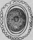 Egg of Ascaris Lumbricoides (Leuckart) with Shell and Albuminous Envelope