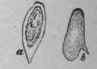 Eggs of Distoma Haematobium
