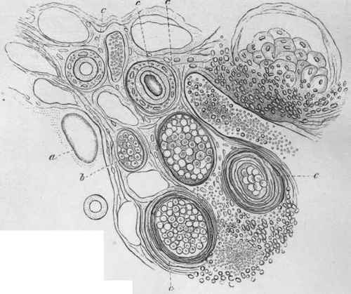 cyst in all its phases
