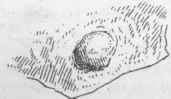 A small psammoma of the dura mater, natural size.