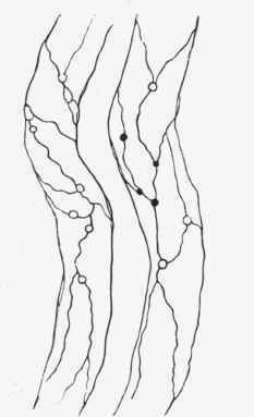 Capillaries after passive hyperemia.