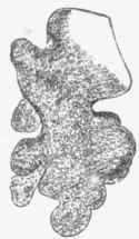 Cast of small bronchus, infundibula, and air vesicles in pneumonia, x 40.