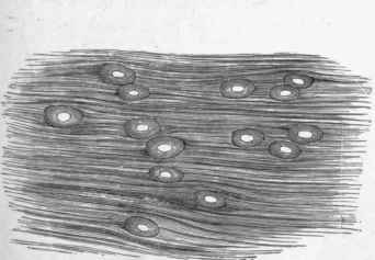 Cysticerci of taenia solium In muscle. Natural size. (Leuckart).