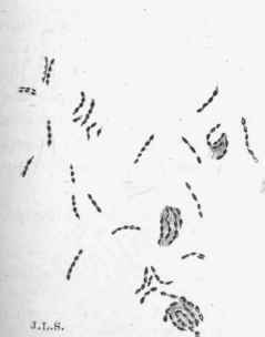 Leprosy bacillus. Those in groups are inside cells.
