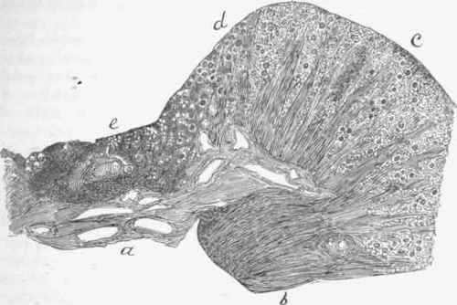 Local atnophy from endarteritis, a, hilum of kidney; B, normal pyramid.