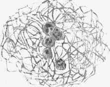 Polymorphonuclear leucocytes in fibrinous reticulum.