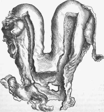 Uterus duplex bicorni.s. The cavities are opened from behind.