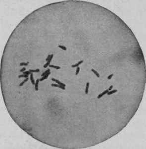 Bacillus DiphtheriAe, Five Hours at 360 C.