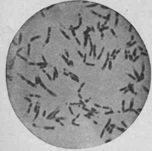 Bacillus DiphtheriAe, Same Culture, Twelve Hours at 360 C.