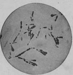 Bacillus Diphtheria, Forty eight Hours at 36° C.